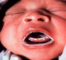 ALGODONCILLO - HIPERnatural.COM