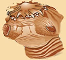 CISTICERCOSIS - HIPERnatural.COM