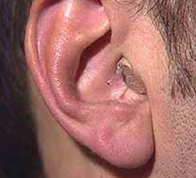 Meniere'sDisease - HIPERnatural.COM