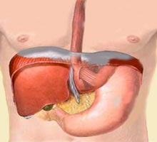 Hiatalhernia - HIPERnatural.COM