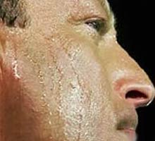 HIPERHIDROSIS - HIPERnatural.COM