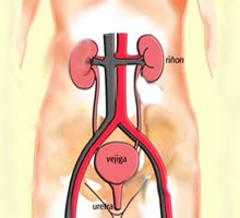 URINARY TRACT INFECTIONS - HIPERnatural.COM