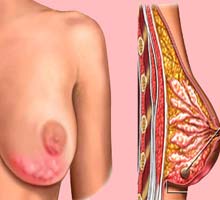 INFLAMMABLEMAMMAIRE - HIPERnatural.COM