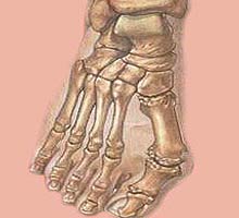 Bunion - HIPERnatural.COM