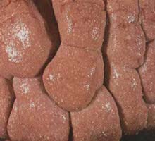 NEFRITIS,GLOMERUNOLEFRITISetPIELONEFRITIS - HIPERnatural.COM