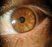 RETINOPATADIABTICA - HIPERnatural.COM