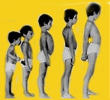 SNDROMEDEDUCHENNE - HIPERnatural.COM