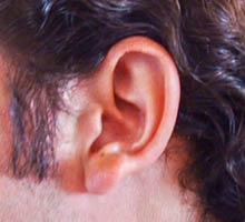 Tinnitusorringingintheear - HIPERnatural.COM